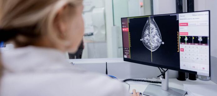 El CIC de Salamanca halla que la cabergolina reduce a la mitad el cáncer de mama en ratones